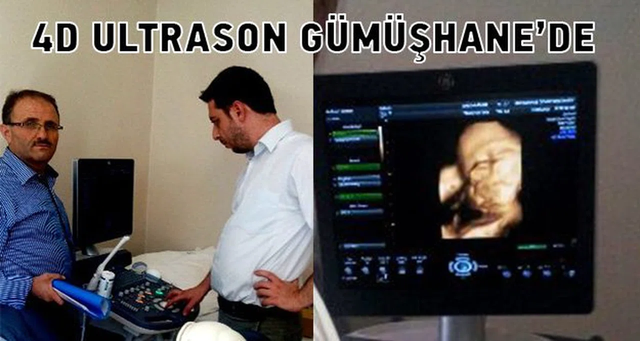Bebek bekleyenler müjde! 4 boyutlu ultrason Gümüşhane’de
