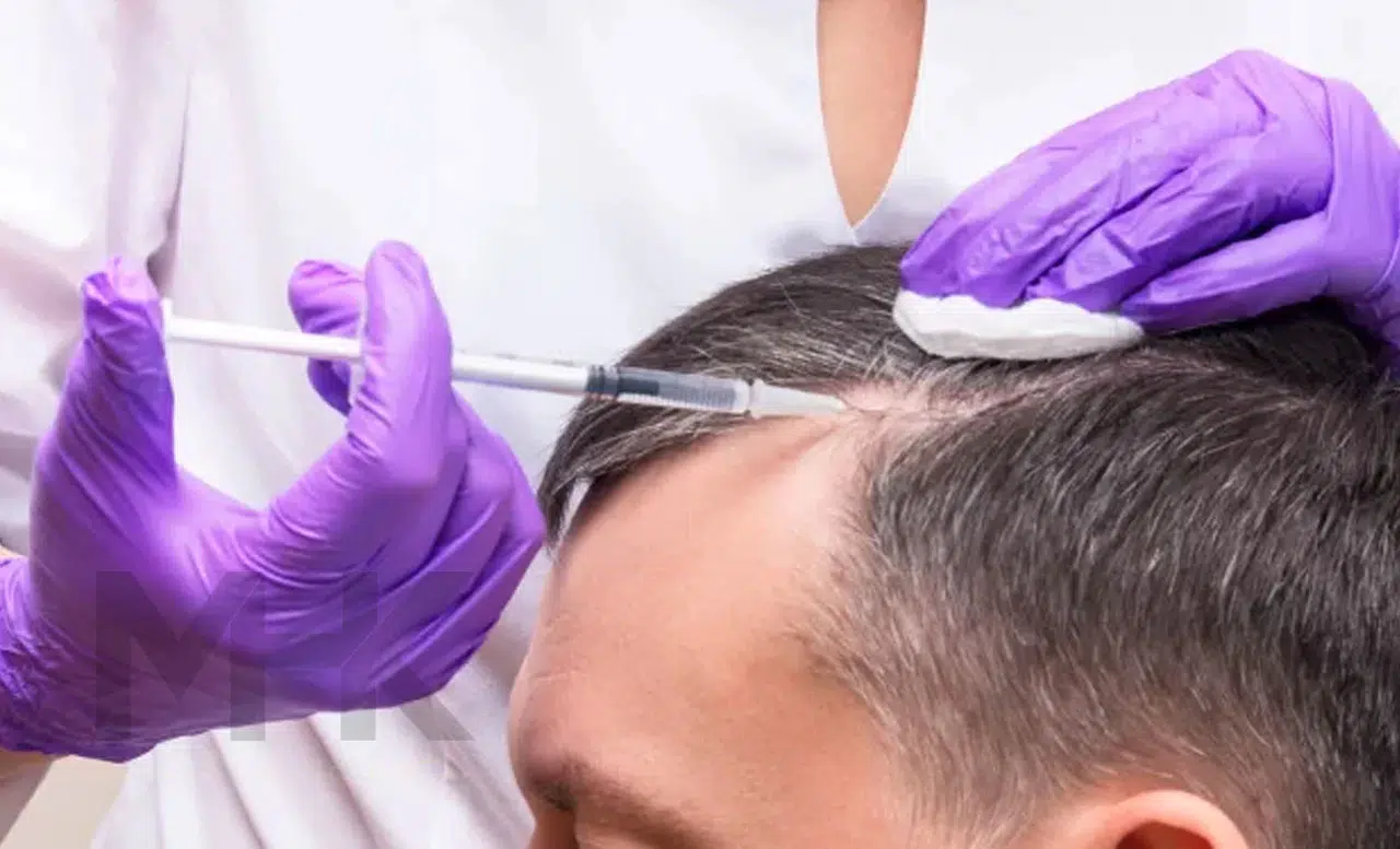 Saç Ekiminde Doğru Hekim ve Klinik Nasıl Seçilir?