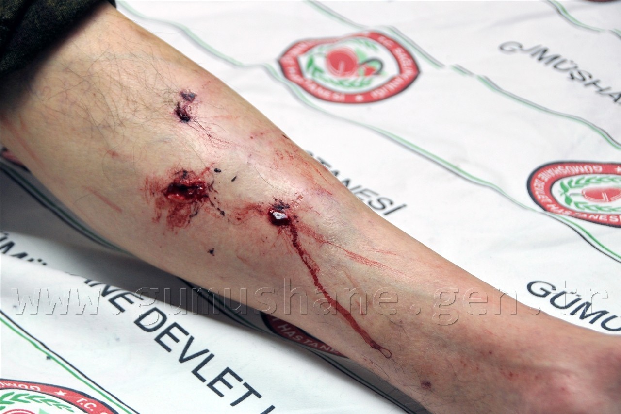 Mantar Toplamaya Giden Vatandaşa Ayı Saldırdı 2