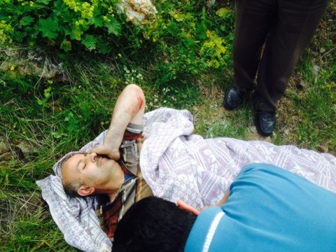 Gümüşhane'de Trafik Kazası: 1 Yaralı 3