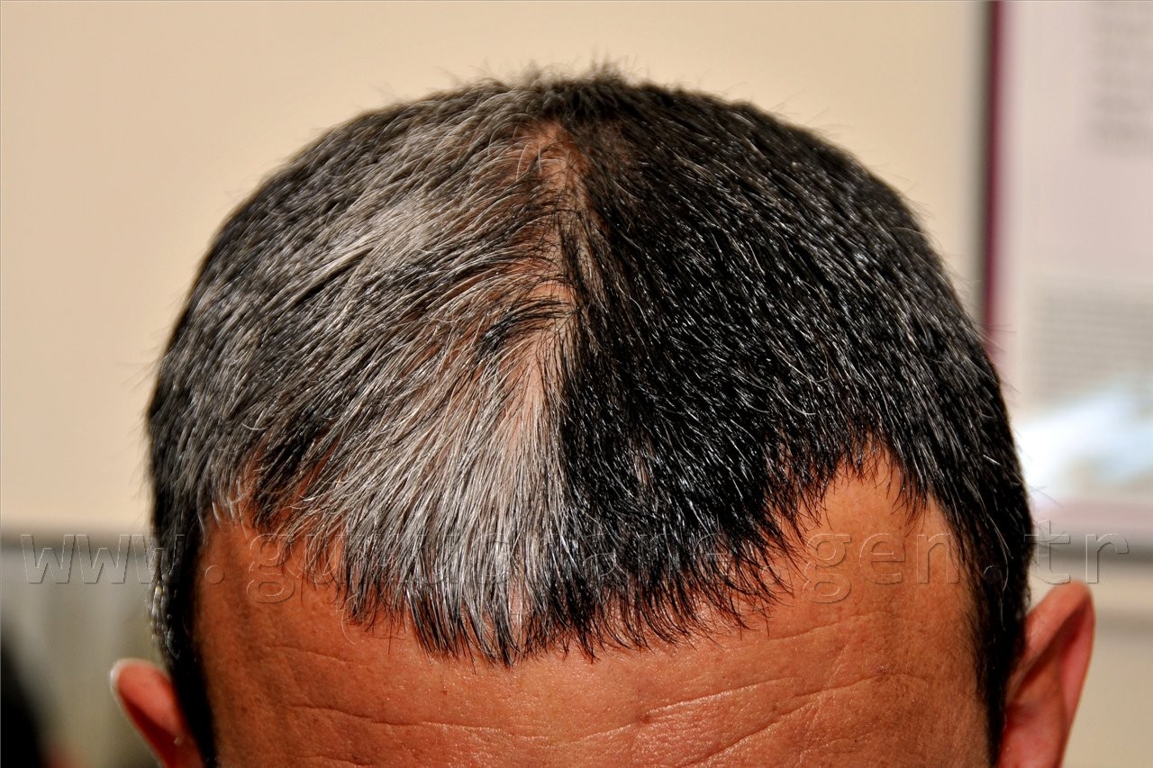 Boya Değil, Orjinal ! 1