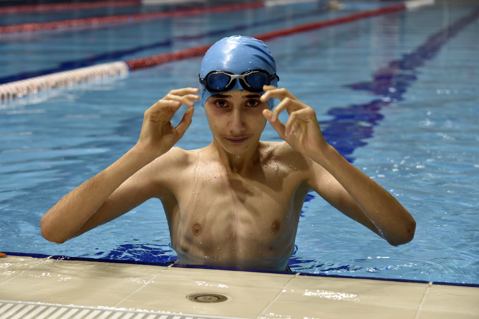 Yüzme ile ameliyattan kurtuldular 2